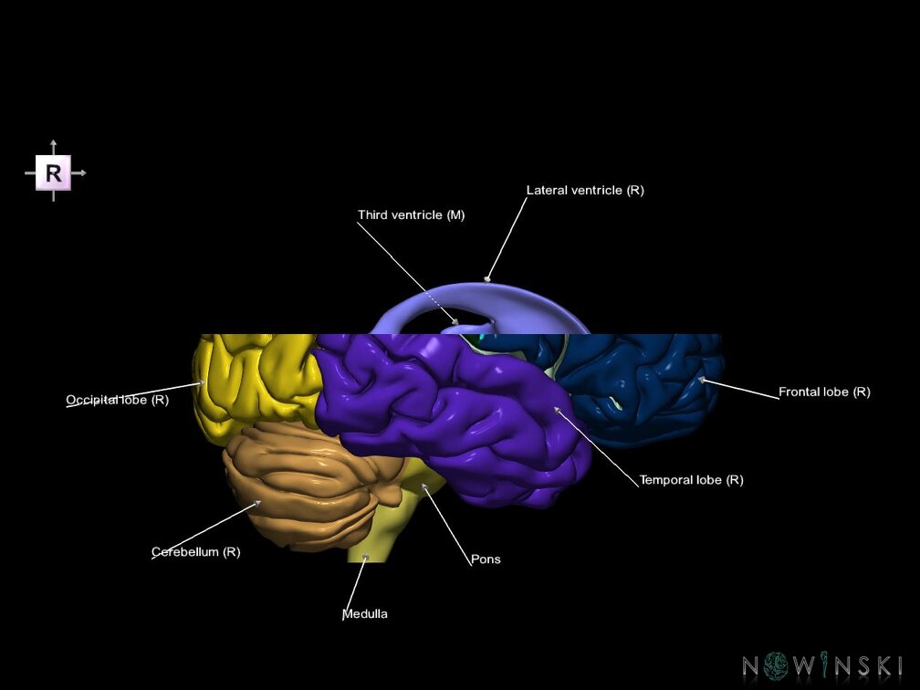 G7.T2.1-12.V4.Ds10.C2.L1.Brain superior cut–Cerebral ventricles