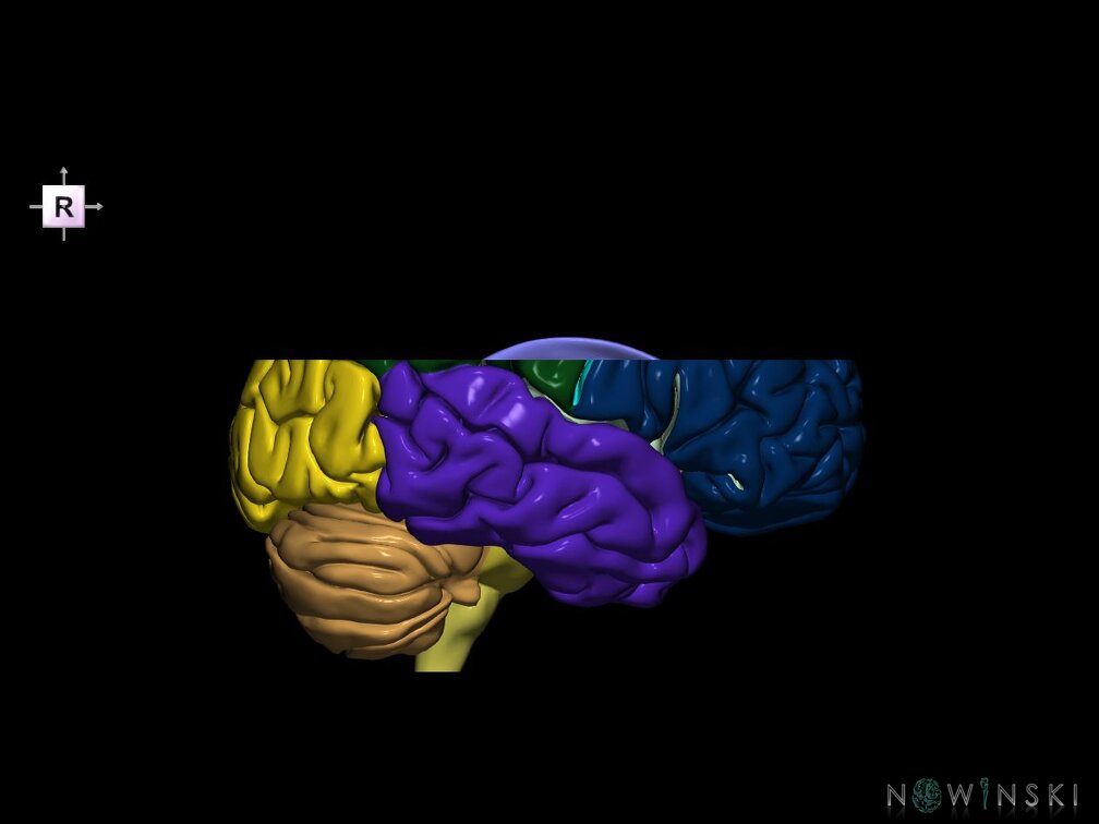 G7.T2.1-12.V4.Ds20.C2.L0.Brain superior cut–Cerebral ventricles