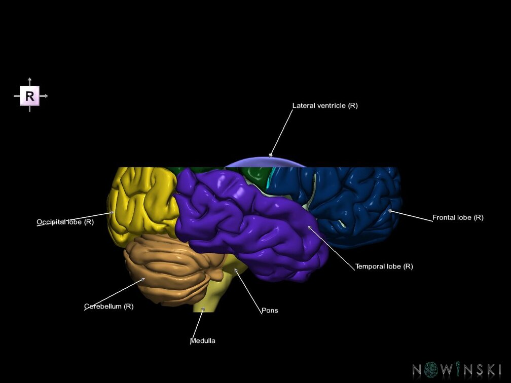 G7.T2.1-12.V4.Ds20.C2.L1.Brain superior cut–Cerebral ventricles