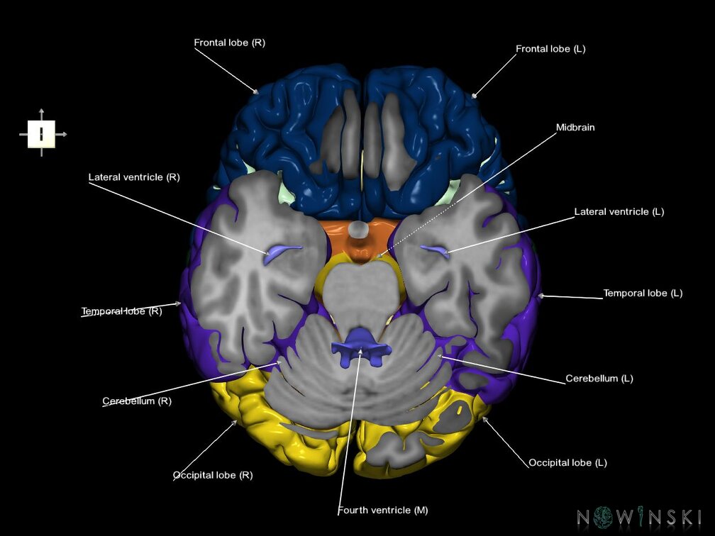 G7.T2.1-12.V6.Di-20.C2.L1.Brain inferior cut–Cerebral ventricles