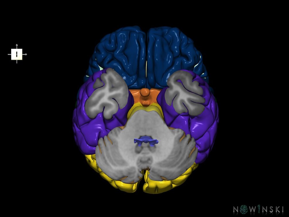 G7.T2.1-12.V6.Di-30.C2.L0.Brain inferior cut–Cerebral ventricles