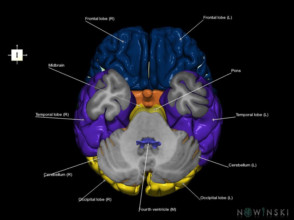 G7.T2.1-12.V6.Di-30.C2.L1.Brain inferior cut–Cerebral ventricles