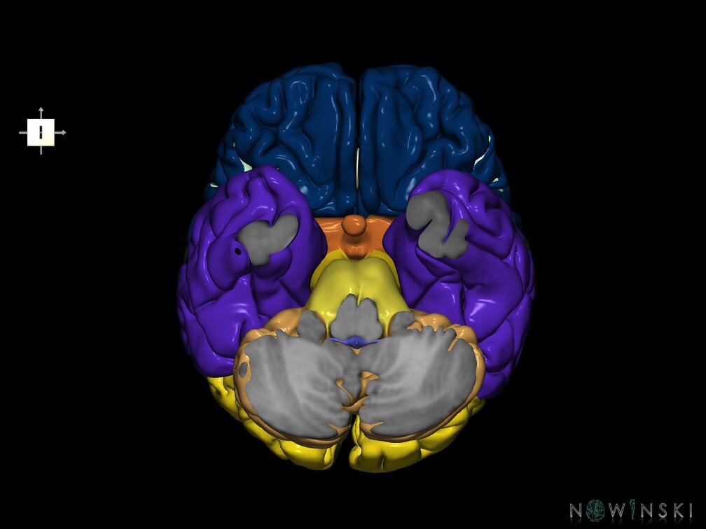 G7.T2.1-12.V6.Di-40.C2.L0.Brain inferior cut–Cerebral ventricles