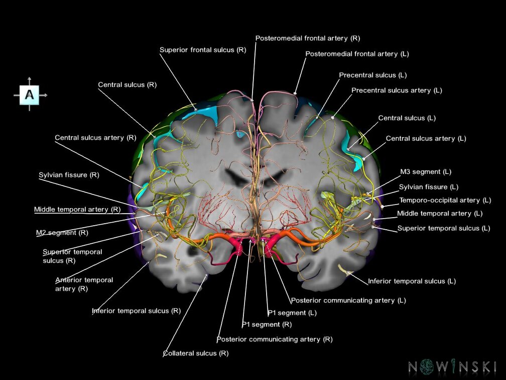 G7.T3.1-15.2.V1.Da-10.C4-2.L1.Whole cerebrum antero-posterior cut–All intracranial arteries