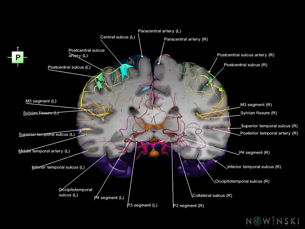 G7.T3.1-15.2.V3.Dp-30.C4-2.L1.Whole cerebrum antero-posterior cut–All intracranial arteries
