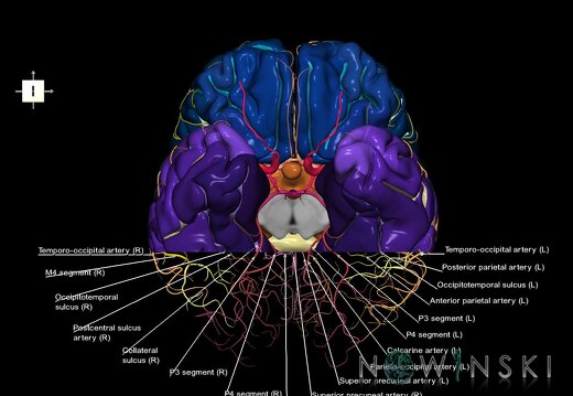G7.T3.1-15.2.V6.Dp-40.C4-2.L1.Whole cerebrum antero-posterior cut–All intracranial arteries