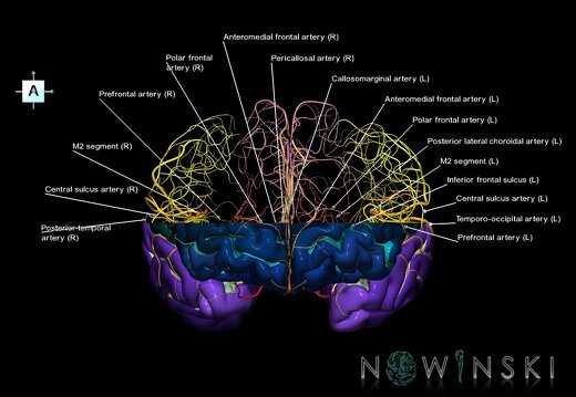 G7.T3.1-15.2.V1.Ds10.C4-2.L1.Whole cerebrum supero-inferior cut–All intracranial arteries