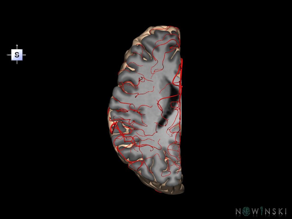 G7.T3.2-15.3.V5.Ds20.C1.L0.Left cerebrum supero-inferior cut–Left intracranial arteries