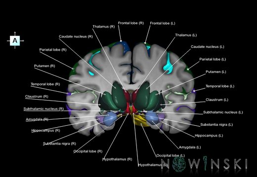 G7.T3.1-11.V1.Da-20.C2.L1.Cerebrum anterior cut–Deep nuclei