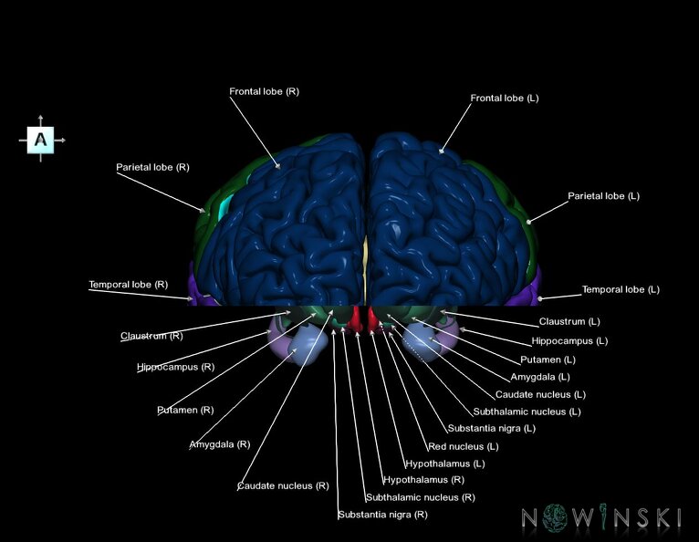 G7.T3.1-11.V1.Di00.C2.L1.Cerebrum_inferior_cut–Deep_nuclei.tiff