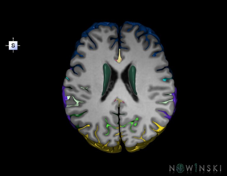 G7.T3.1-11.V5.Ds20.C2.L0.Cerebrum_superior_cut–Deep_nuclei.tiff