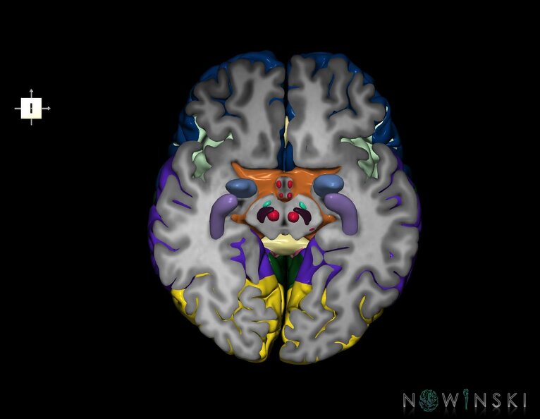 G7.T3.1-11.V6.Di-10.C2.L0.Cerebrum_inferior_cut–Deep_nuclei.tiff