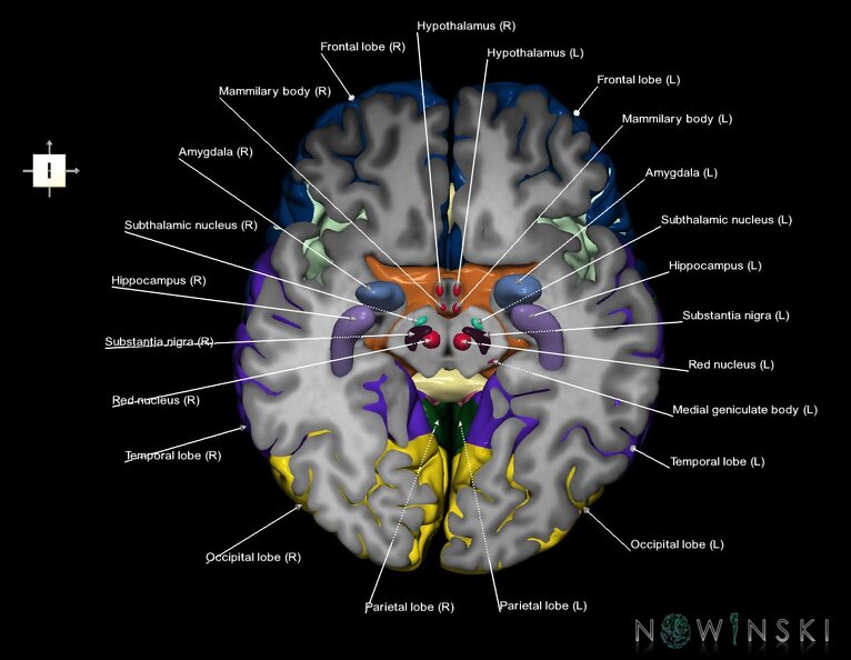 G7.T3.1-11.V6.Di-10.C2.L1.Cerebrum_inferior_cut–Deep_nuclei.tiff