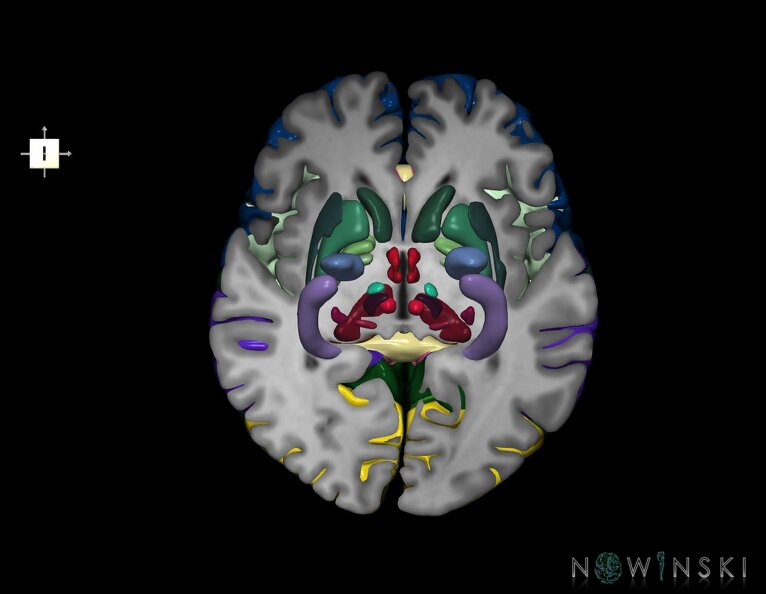 G7.T3.1-11.V6.Di00.C2.L0.Cerebrum_inferior_cut–Deep_nuclei.tiff