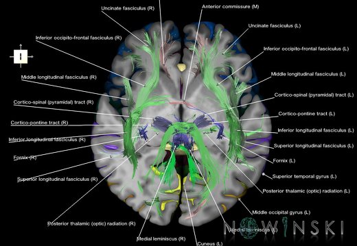 G7.T3.1-14.1.V6.Di00.C3-2.L1.Cerebrum inferior cut–White matter tracts all