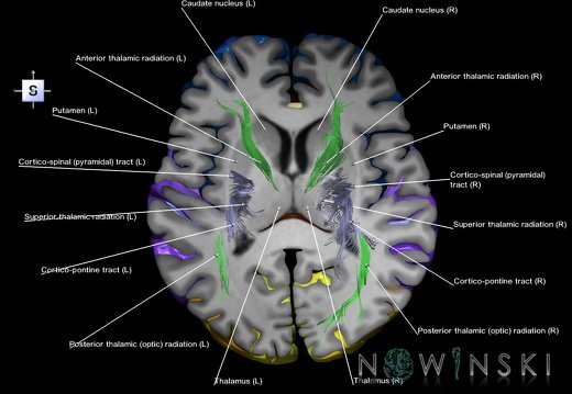 G7.T3.1-14.4.V5.Ds10.C3-2.L1.Cerebrum superior cut–Projection tracts