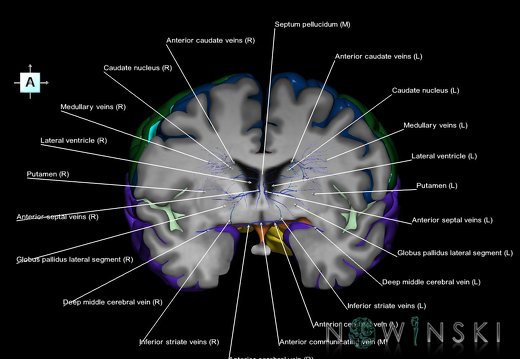 G7T3.1-16.6.CerebrumAnteroPosteriorCut-DeepCerebralVeins