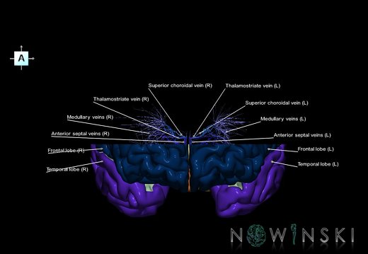 G7.T3.1-16.6.V1.Ds10.C2.L1.Cerebrum superior cut–Deep veins