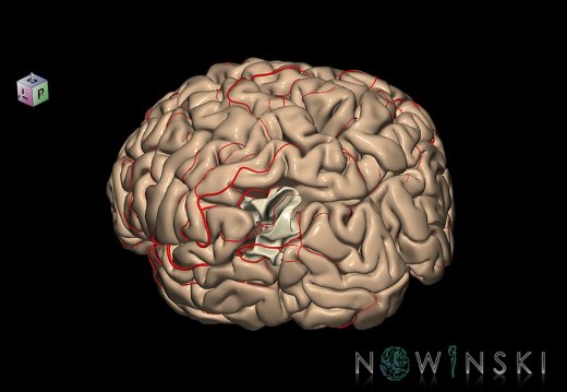 G8.T3.1-6 6.1-13.4-15.2.V7.C1.L0.Cerebrum-No angular gyrus left-White matter-Intracranial arteries