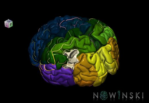 G8.T3.1-6 6.1-13.4-15.2.V7.C2.L0.Cerebrum-No angular gyrus left-White matter-Intracranial arteries