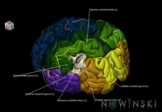 G8.T3.1-6 6.1-13.4-15.2.V7.C2.L1.Cerebrum-No angular gyrus left-White matter-Intracranial arteries