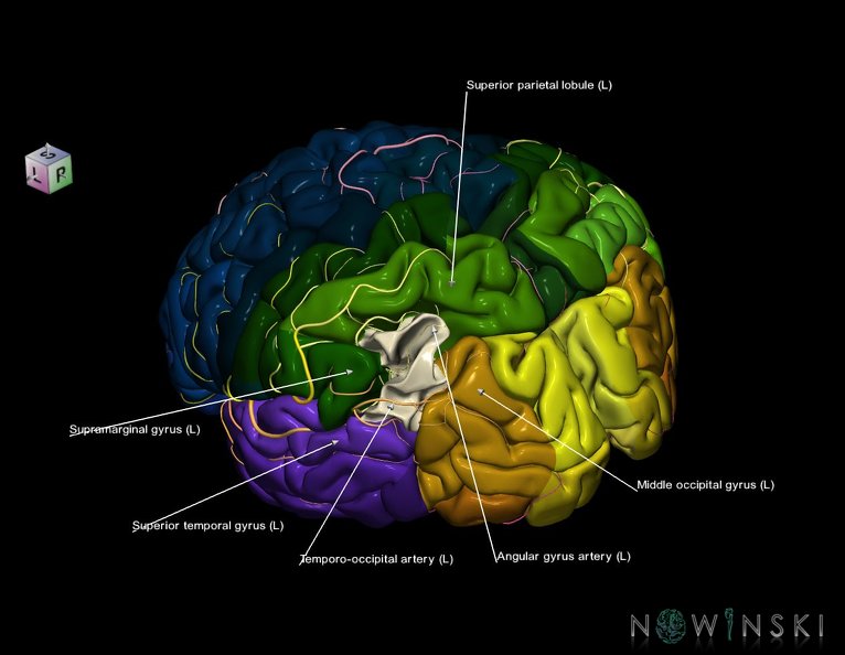 G8.T3.1-6_6.1-13.4-15.2.V7.C2.L1.Cerebrum-No_angular_gyrus_left-White_matter-Intracranial_arteries.tiff