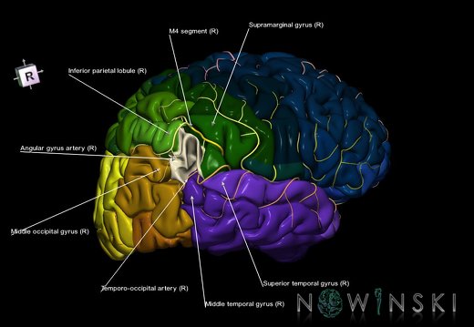 G8.T3.1-6 6.1-13.4-15.2.V8.C2.L1.Cerebrum-No angular gyrus right-White matter-Intracranial arteries