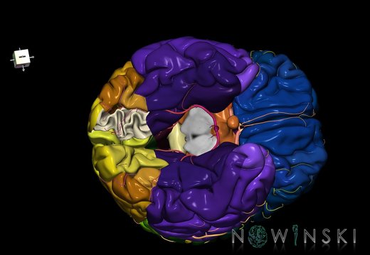 G8.T3.1-6 6.11-13.4-15.2.V8.C2.L0.Cerebrum-No lingual gyrus right-WM-Intracranial arteries