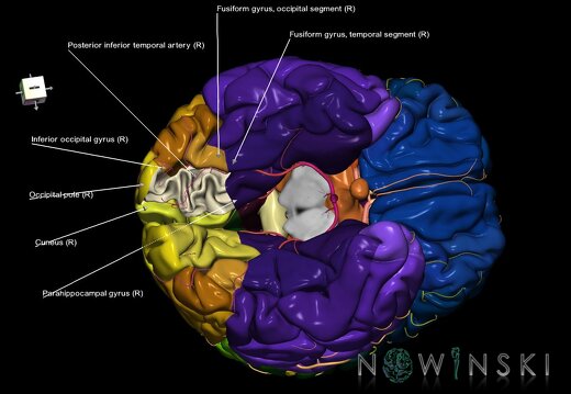 G8.T3.1-6 6.11-13.4-15.2.V8.C2.L1.Cerebrum-No lingual gyrus right-WM-Intracranial arteries