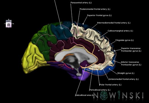 G8.T3.2-6 6.12-13.4-15.3.V7.C2.L1.Cerebrum-No medial frontal gyrus left-WM-Intracranial arteries