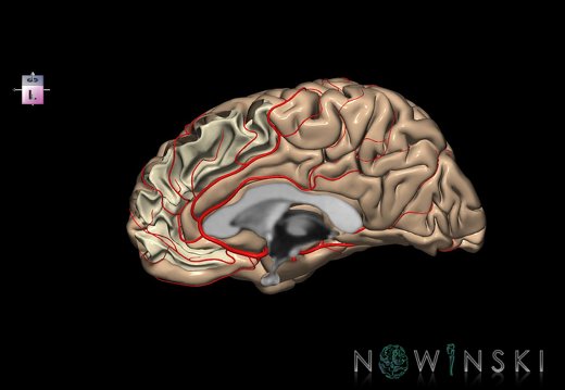 G8.T3.3-6 6.12-13.4-15.4.V8.C1.L0.Cerebrum-No medial frontal gyrus right-WM-Intracranial arteries