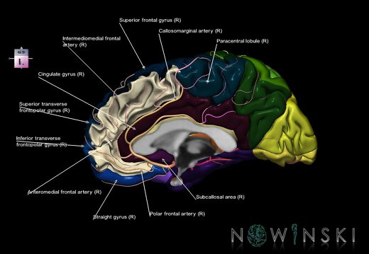 G8.T3.3-6 6.12-13.4-15.4.V8.C2.L1.Cerebrum-No medial frontal gyrus right-WM-Intracranial arteries