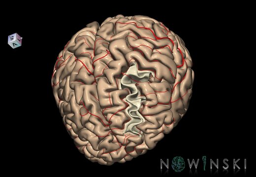 G8.T3.1-6 6.13-13.4-15.2.V7.C1.L0.Cerebrum-No middle frontal gyrus left-WM-Intracranial arteries