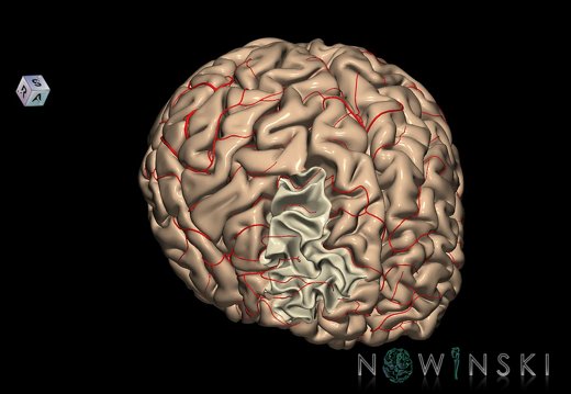 G8.T3.1-6 6.13-13.4-15.2.V8.C1.L0.Cerebrum-No middle frontal gyrus right-WM-Intracranial arteries