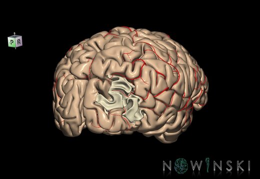 G8.T3.1-6 6.14-13.4-15.2.V8.C1.L0.Cerebrum-No mid occipital gyrus right-WM-Intracranial arteries