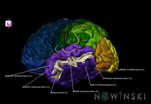 G8.T3.1-6 6.15-13.4-15.2.V7.C2.L1.Cerebrum-No mid temporal gyrus left-WM-Intracranial arteries