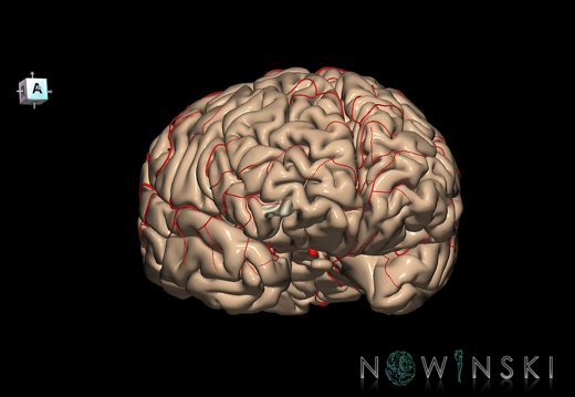 G8.T3.1-6 6.16.1-13.4-15.2.V7.C1.L0.Cerebrum-No ant orbital gyri left-WM-Intracranial arteries