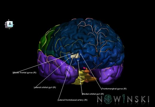 G8.T3.1-6 6.16.1-13.4-15.2.V7.C2.L1.Cerebrum-No ant orbital gyri left-WM-Intracranial arteries