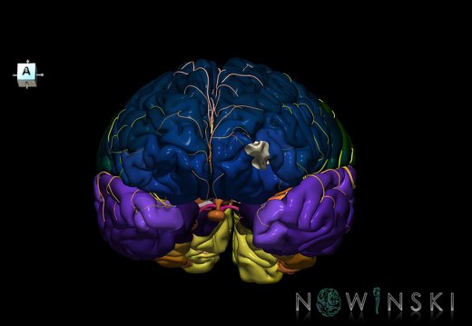 G8.T3.1-6 6.16.1-13.4-15.2.V8.C2.L0.Cerebrum-No ant orbital gyri right-WM-Intracranial arteries