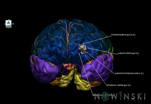 G8.T3.1-6 6.16.1-13.4-15.2.V8.C2.L1.Cerebrum-No ant orbital gyri right-WM-Intracranial arteries