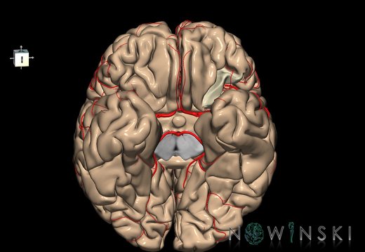 G8.T3.1-6 6.16.4-13.4-15.2.V7.C1.L0.Cerebrum-No post orbital gyri left-WM-Intracranial arteries