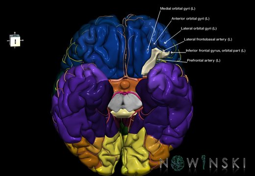 G8.T3.1-6 6.16.4-13.4-15.2.V7.C2.L1.Cerebrum-No post orbital gyri left-WM-Intracranial arteries