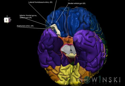 G8.T3.1-6 6.16.4-13.4-15.2.V8.C2.L1.Cerebrum-No post orbital gyri right-WM-Intracranial arteries