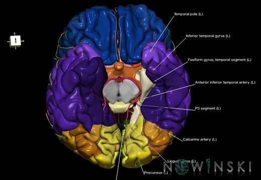 G8.T3.1-6 6.18-13.4-15.2.V7.C2.L1.Cerebrum-No parahippocampal gyrus left-WM-Intracranial arteries