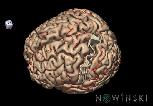 G8.T3.1-6 6.19-13.4-15.2.V7.C1.L0.Cerebrum-No postcentral gyrus left-WM-Intracranial arteries