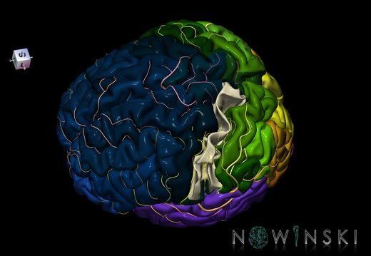 G8.T3.1-6 6.19-13.4-15.2.V7.C2.L0.Cerebrum-No postcentral gyrus left-WM-Intracranial arteries