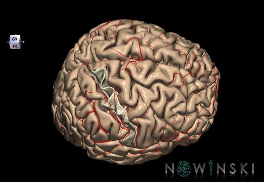 G8.T3.1-6 6.19-13.4-15.2.V8.C1.L0.Cerebrum-No postcentral gyrus right-WM-Intracranial arteries