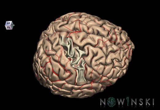G8.T3.1-6 6.20-13.4-15.2.V8.C1.L0.Cerebrum-No precentral gyrus right-WM-Intracranial arteries