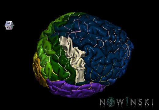 G8.T3.1-6 6.20-13.4-15.2.V8.C2.L0.Cerebrum-No precentral gyrus right-WM-Intracranial arteries