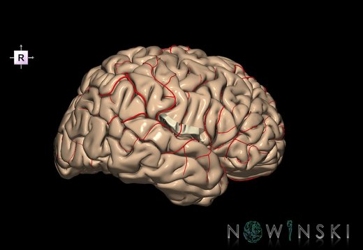 G8.T3.1-6 6.23-13.4-15.2.V8.C1.L0.Cerebrum-No subcentral gyrus right-WM-Intracranial arteries